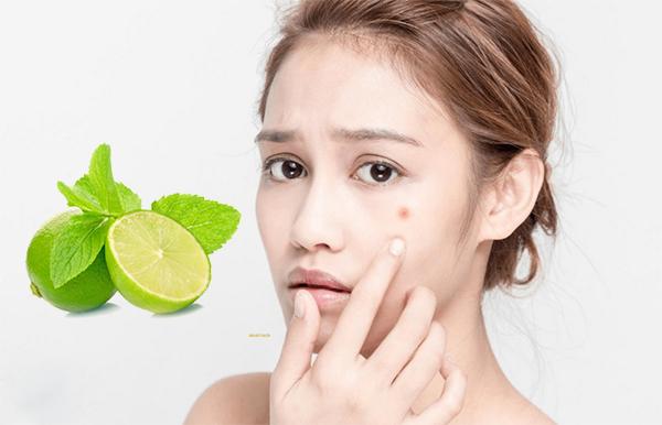 Cách Trị Mụn Tại Nhà An Toàn, Hiệu Quả